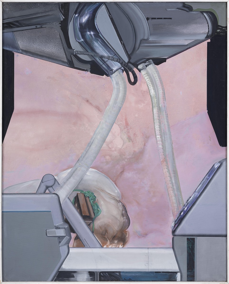 Observation (Transplantation II / Graft)