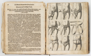 Unikátní dvoudílná lékařská kniha o chirurgii z roku 1666 - “CHIRURGISCH ZEUG-HAUS”, D. Sculteti